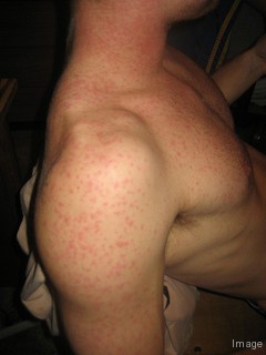 Red dots on skin